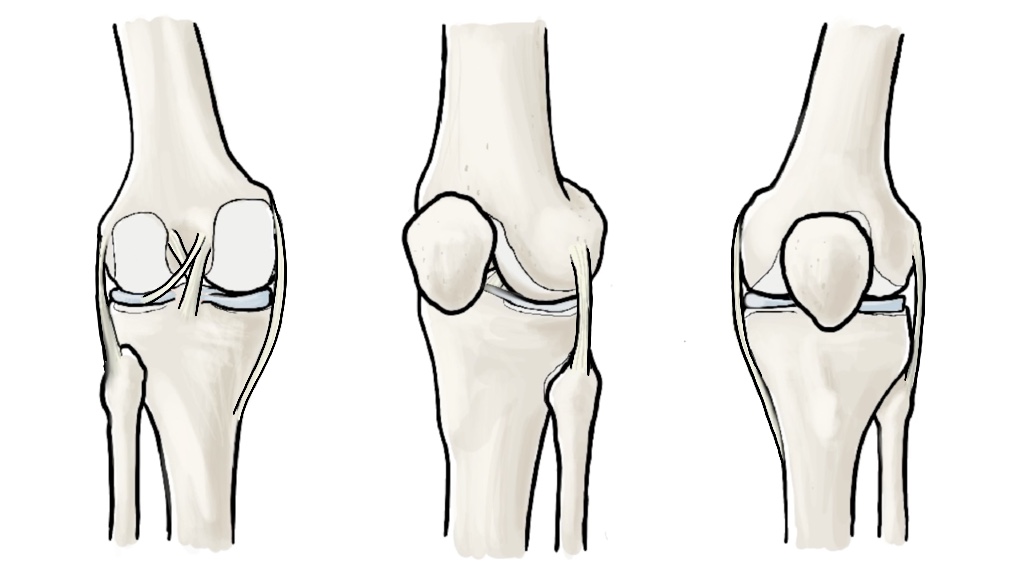 AA 09 Knee Joint